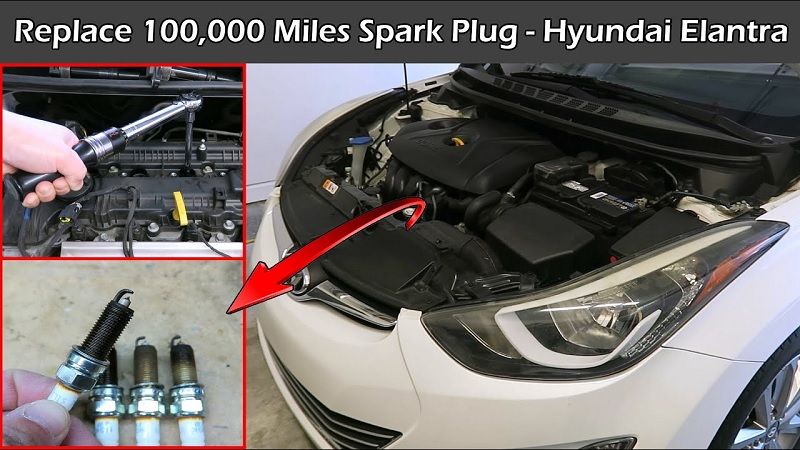 2015 Hyundai Elantra Spark Plugs